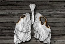 cancer de pulmon