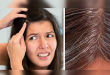 canas