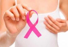 cancer de mama