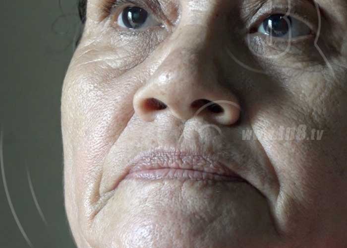 cancer-mama-003 nicaragua