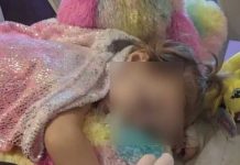 Niña de 2 años es diagnosticada con una terrible enfermedad