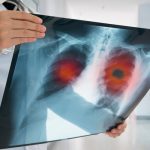 Con este mecanismo pretenden detener el desarrollo del cáncer medicina