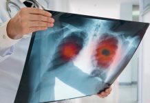 Con este mecanismo pretenden detener el desarrollo del cáncer medicina