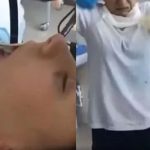 Extraen serpiente de más de un metro de la garganta de una mujer en Rusia (VIDEO) rusia