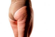 exilis