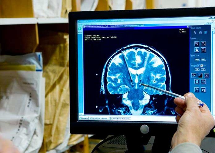 cere_Pe0DPoh estrategias