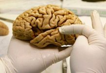 Partes del cerebro libres de alzheimer salud
