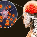 El coronavirus es capaz de invadir el cerebro, según estudio estados unidos