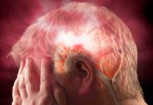 Liquido de tejido cerebral muerto puede dañar parte sana del cerebro ataque cerebral