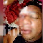 nicaragua, chontales, golpiza, sujetos desconocidos,
