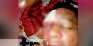 nicaragua, chontales, golpiza, sujetos desconocidos,