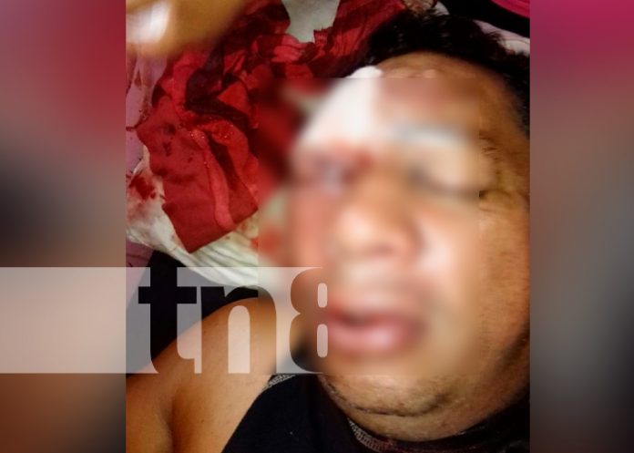 nicaragua, chontales, golpiza, sujetos desconocidos,