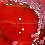 4 bebés murieron en Italia a causa de una bacteria italia