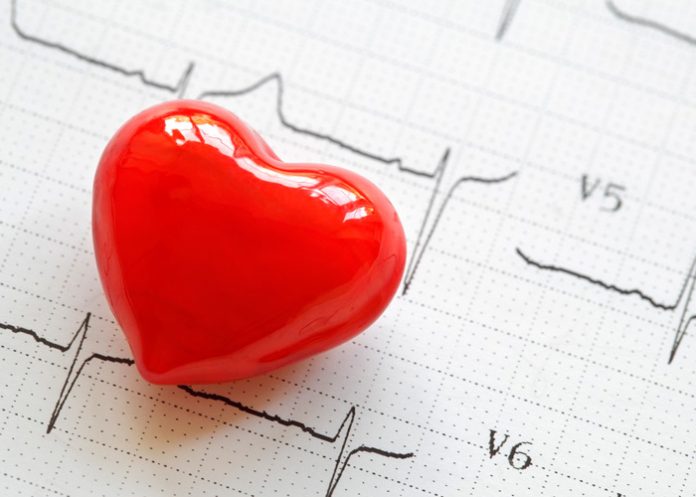 co_n26wfgq diferencias