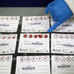 «Estoy desmoralizado»: Un hombre da positivo por coronavirus 15 veces en Italia nicaragua