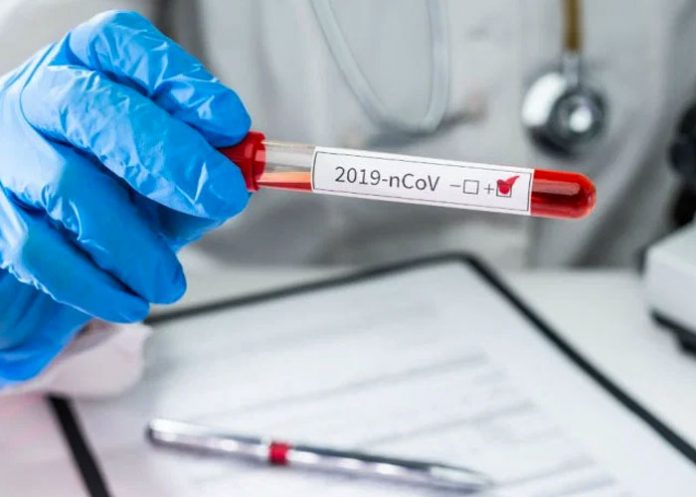 coronavirus-_XjRAF6l puerto rico