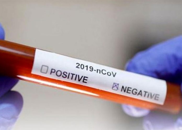 coronavirus-negativo nicaragua