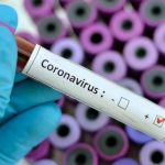 Nicaragua vigilante y muy atenta para evitar el coronavirus nicaragua
