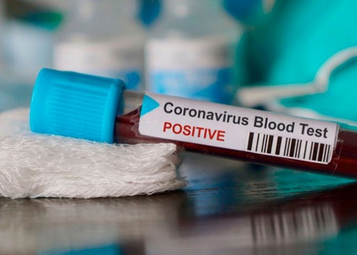 coronavirus-sica-1 nicaragua