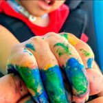 Fallece uno de los siameses ticos separados hace tres años costa rica