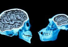 Por esta razón es más grande el cerebro humano tamano del cerebro