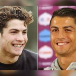 Médico revela a cuántas cirugías plásticas se sometió Cr7 europa