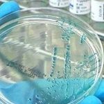 salud, vacuna, malaria, avance,