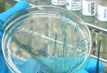 Desarrollan primera vacuna contra la malaria que muestra un 77 % de eficacia salud, vacuna, malaria, avance,