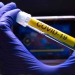 Costa Rica suma su cuarto fallecido por coronavirus costa rica