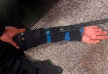Detenido en París un hombre que escondía en su chaqueta largas cuchillas francia