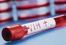 Un tercer paciente con VIH podría haber sido curado en Alemania alemania