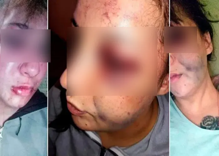 desfiguro_ex_mujer_ argentina