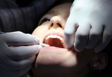 Descubren una técnica segura para blanquear los dientes dientes blancos