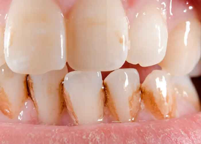 dientes_khjOlOF salud