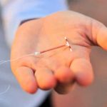 Vietnam: Bebé nace con el DIU de su madre en la mano (FOTO) vietnam