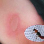 Honduras en alerta por aparición de la plaga del «latigazo» honduras