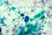 El parásito intestinal que se convirtió en enfermedad de transmisión sexual parasito intestinal