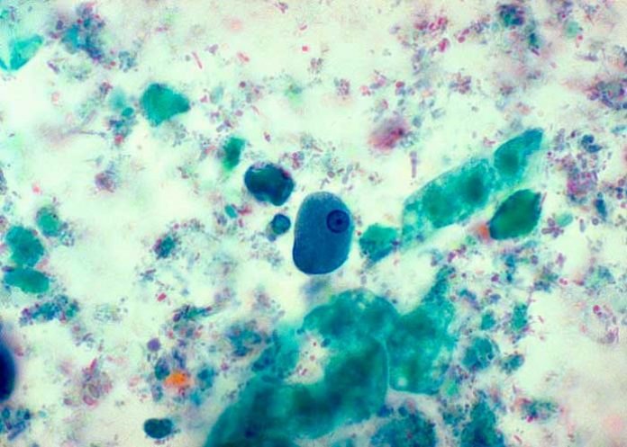 en_6K7ozbY parasito intestinal