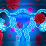 Síntomas de la endometriosis que no debes pasar por alto endometriosis