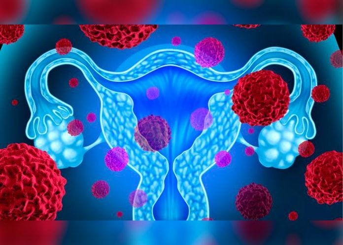 endo_JIbOiio endometriosis