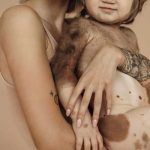 Hijo de una bloguera nació con una extraña y peligrosa enfermedad rusia