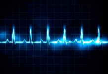 ¿Sabes de la cardiopatía isquémica? Afecta a este tipo de mujeres