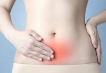 ¿Qué es la endometriosis? endometriosis