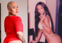 Fan de Kim Kardashian gastó 15 mil dólares para tener su trasero, pero cirugía se le pudrió turquia