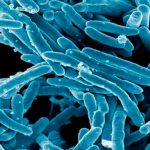 tuberculosis