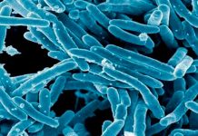 Los colonizadores europeos expandieron la tuberculosis tuberculosis