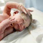 ¿Qué es la capita blanca con la que nacen los recién nacidos? vernix caseoso