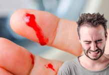 Esta es la razón por la que duele tanto cortarse el dedo con papel heridas