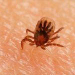 Mira la escalofriante escena de garrapatas excavando la piel (VIDEO) garrapatas