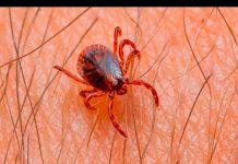 ¿Qué hacer ante la picadura de una garrapata? que hacer
